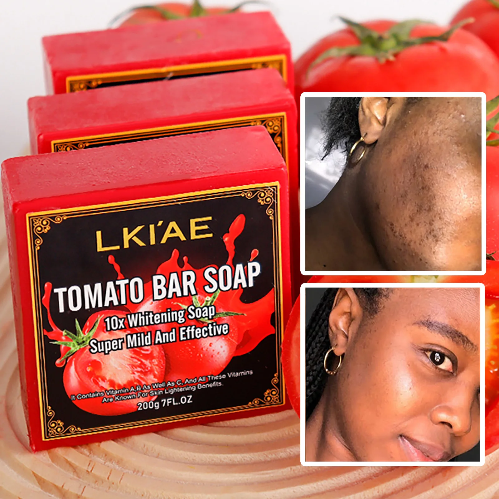 LKIAE Ultra Lightening Tomato Soap Bar, против темных, черных пятен, прыщей, ровных тонов кожи, веганское мыло для ванны для всех типов кожи, 200 г
LKIAE Ultra Lightening Tomato Soap Bar, против темных, черных пятен, прыщей, ровных тонов кожи, веганское мыло для ванны для всех типов кожи, 200 г