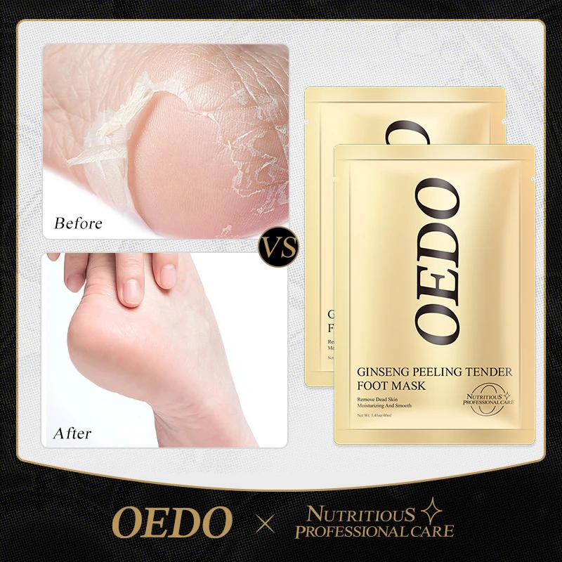2Packs Feet Exfoliating Foot Mask Magic Skin Peeling Dead Skin Feet Mask Socks Sosu Socks For Pedicure Socks Foot Mask Foot
2Packs Feet Exfoliating Foot Mask Magic Skin Peeling Dead Skin Feet Mask Socks Sosu Socks For Pedicure Socks Foot Mask Foot
