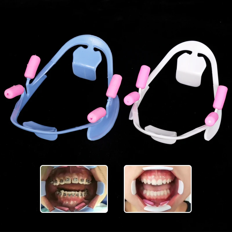 1pc 3D Cheek Retractor Teeth Whitening Mouth Opener Dental Mouth Spreader Lip Shape Opener Dentist Orthodontic Tools Blue White
1pc 3D Cheek Retractor Teeth Whitening Mouth Opener Dental Mouth Spreader Lip Shape Opener Dentist Orthodontic Tools Blue White