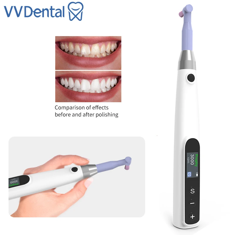 VVDental Dental Cordless Polishing Wireless Electric Motor With Prophy Angles Machine Prophy Motor 3000rpm Rechargeable
VVDental Dental Cordless Polishing Wireless Electric Motor With Prophy Angles Machine Prophy Motor 3000rpm Rechargeable