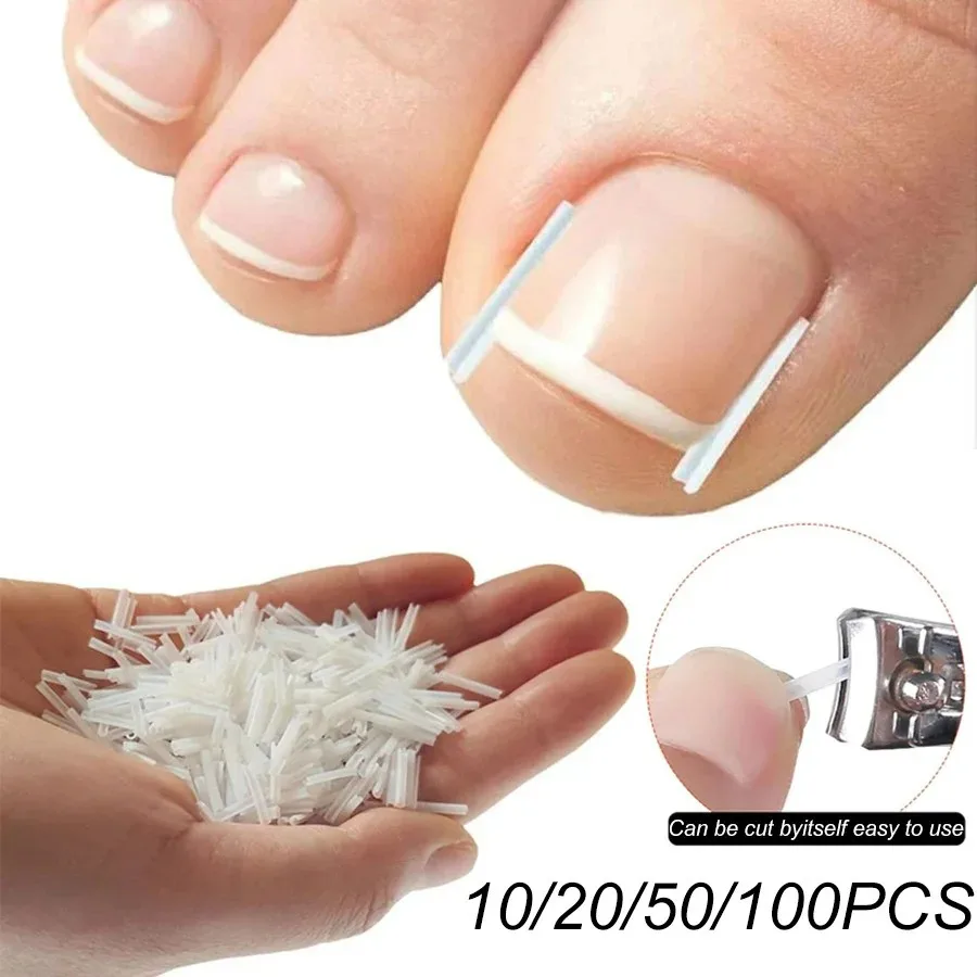 Elastic C-shaped Tube Pad for Toe Nail Ingrown Toenail Corrector Tools Foot Care Invisible Groove Straightening Clip Treatment
Elastic C-shaped Tube Pad for Toe Nail Ingrown Toenail Corrector Tools Foot Care Invisible Groove Straightening Clip Treatment