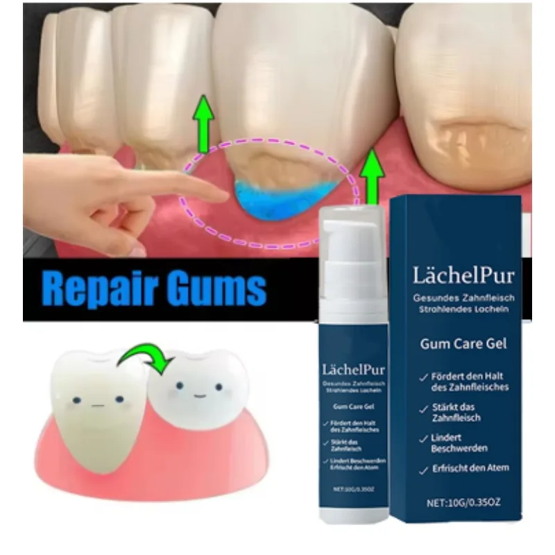 Гель для ухода за поврежденными деснами, снимает боль в деснах, алергия, глубокая очистка пятен на зубах, сыворотка для зубного камня, зубная паста для кариеса
Гель для ухода за поврежденными деснами, снимает боль в деснах, алергия, глубокая очистка пятен на зубах, сыворотка для зубного камня, зубная паста для кариеса