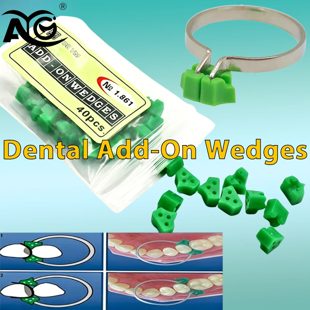 AG 40pcs/bag Dental Silicone Wedges Add On Wedges Rubber No 1.861 Delta Ring Tine Dentist Material Dentist Tools No 1.398/1.330
AG 40pcs/bag Dental Silicone Wedges Add On Wedges Rubber No 1.861 Delta Ring Tine Dentist Material Dentist Tools No 1.398/1.330
