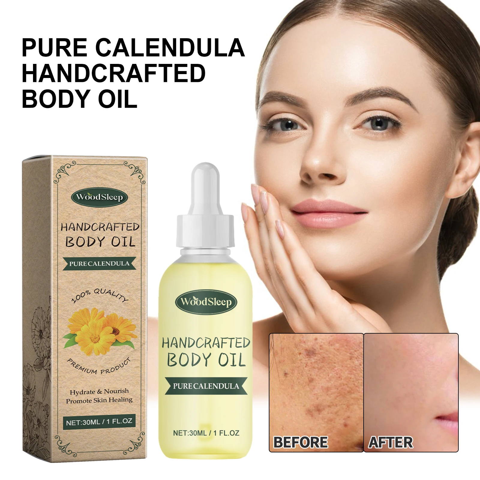 WoodSleep Pure Calendula Handcrafted Body Oil Reduce Scar Skin Redness Moisturizing Smooth Firming Care
WoodSleep Pure Calendula Handcrafted Body Oil Reduce Scar Skin Redness Moisturizing Smooth Firming Care