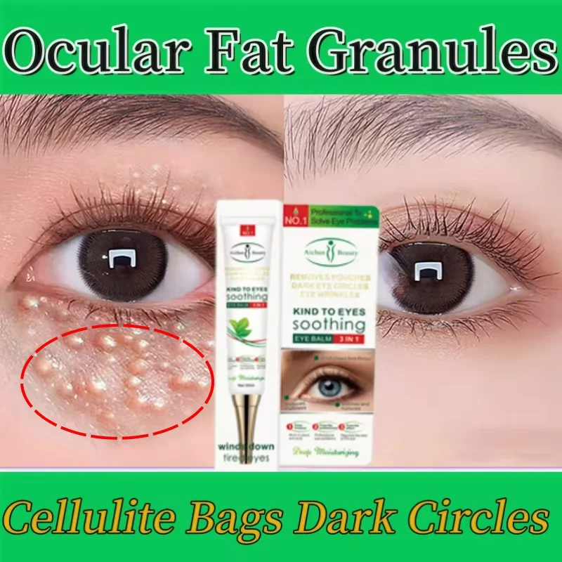 Fat Granules Remover Eye Cream Remove Dark Circle Anti-puffiness Wrinkle Firming Cream Fade Fine Line Eye Anti-aging Beauty Care
Fat Granules Remover Eye Cream Remove Dark Circle Anti-puffiness Wrinkle Firming Cream Fade Fine Line Eye Anti-aging Beauty Care