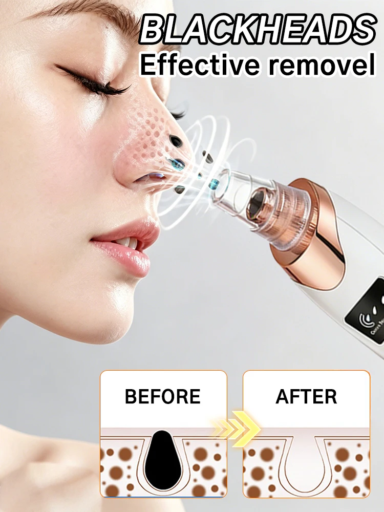 Vacuum Blackhead Remover 3 Levels Suction Pore Cleanser for Nose Face for Acne Grease Dead Skin Removal Safe for All Skin Types
Vacuum Blackhead Remover 3 Levels Suction Pore Cleanser for Nose Face for Acne Grease Dead Skin Removal Safe for All Skin Types
