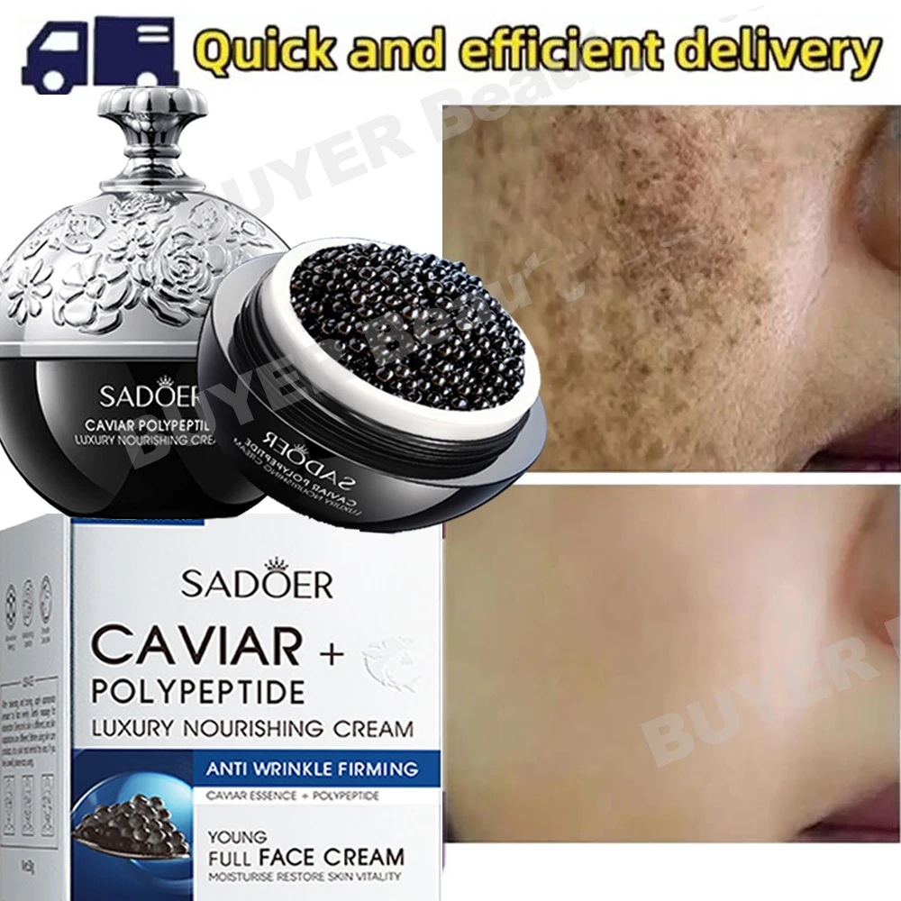Effective Whitening Freckle Remove Melasma Cream Caviar Face Cream Remove Dark Spots Melanin Brighten Repair Skin Care Cosmetics
Effective Whitening Freckle Remove Melasma Cream Caviar Face Cream Remove Dark Spots Melanin Brighten Repair Skin Care Cosmetics