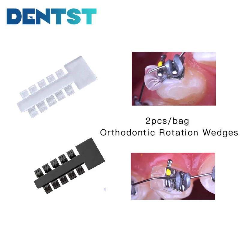 Ортодонтическая вращающаяся клиновидная крутящаяся Подушка Dentst, 2 шт./упаковка = 4 палочки, 40 одиночных ортодонтических крутящих подушечек
Ортодонтическая вращающаяся клиновидная крутящаяся Подушка Dentst, 2 шт./упаковка = 4 палочки, 40 одиночных ортодонтических крутящих подушечек