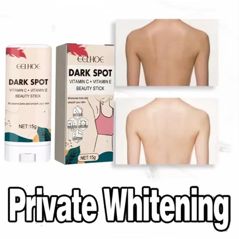 Effective Improve Body Whitening Cream Armpit Legs Knee Elbow Bleaching Cream Dull Remove Dark Spots Melanin Brighten Skin Care
Effective Improve Body Whitening Cream Armpit Legs Knee Elbow Bleaching Cream Dull Remove Dark Spots Melanin Brighten Skin Care