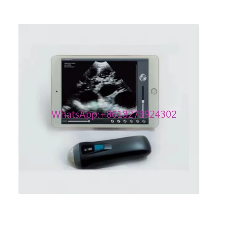 Handheld Ultrasound Machine Portable Pregnancy Test Wireless Mechanical Veterinary Ultrasound Scanner Pig Sheep
Handheld Ultrasound Machine Portable Pregnancy Test Wireless Mechanical Veterinary Ultrasound Scanner Pig Sheep