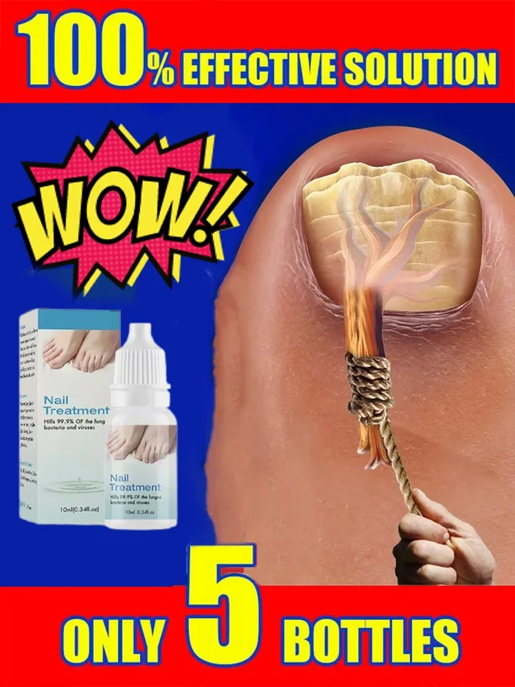 Foot Repair Essence Fungal Treatment Serum Fungal Nail Care Massage Essential Oil4363
Foot Repair Essence Fungal Treatment Serum Fungal Nail Care Massage Essential Oil4363