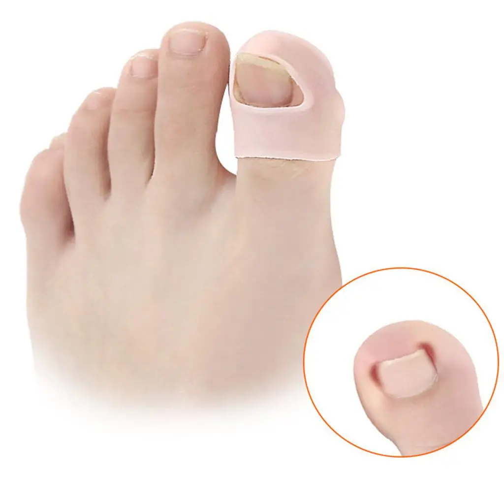 Silicone Toe Orthotics Ingrown Toenail Correction Fixer Soft Gel Nail Brace for Pedicure Treatment
Silicone Toe Orthotics Ingrown Toenail Correction Fixer Soft Gel Nail Brace for Pedicure Treatment