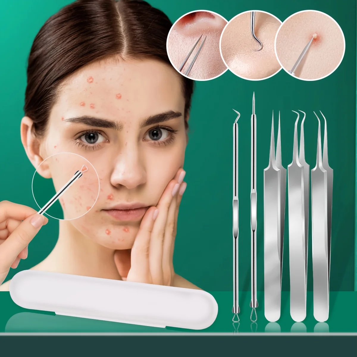 3/5pcs with White Box,Different Blackhead Needle Tips Available,Stainless Steel Blackhead and Pimple Extractor,Men's and Women's
3/5pcs with White Box,Different Blackhead Needle Tips Available,Stainless Steel Blackhead and Pimple Extractor,Men's and Women's
