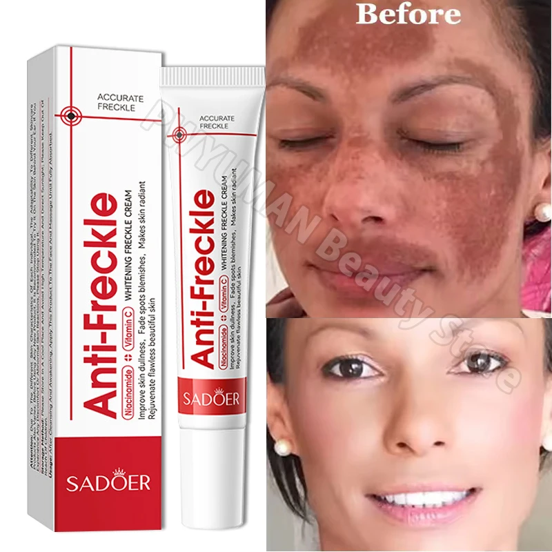 Nicotinamide Whitening Freckles Face Cream Remove Melasma Dark Spots Corrector Fade Melanin Acne Anti-Aging Brighten Skin Care
Nicotinamide Whitening Freckles Face Cream Remove Melasma Dark Spots Corrector Fade Melanin Acne Anti-Aging Brighten Skin Care