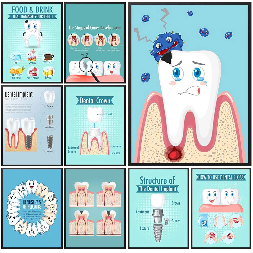 Dental Implant Filling Tooth Dentistry Dentist Poster Wall Art Canvas Painting Home Decor Wall Pictures For Living Room Unframed
Dental Implant Filling Tooth Dentistry Dentist Poster Wall Art Canvas Painting Home Decor Wall Pictures For Living Room Unframed