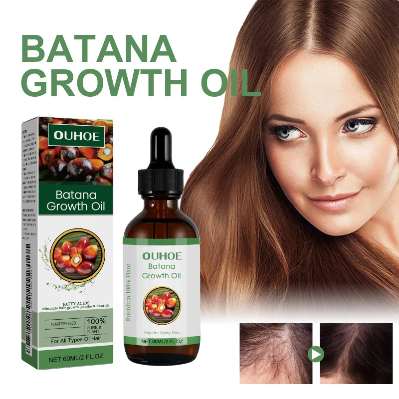 Hair Thickening Oil - Nourishing Scalp Treatment For Fuller Looking Hair, Helps Strengthen Roots & Reduce Breakage
Hair Thickening Oil - Nourishing Scalp Treatment For Fuller Looking Hair, Helps Strengthen Roots & Reduce Breakage