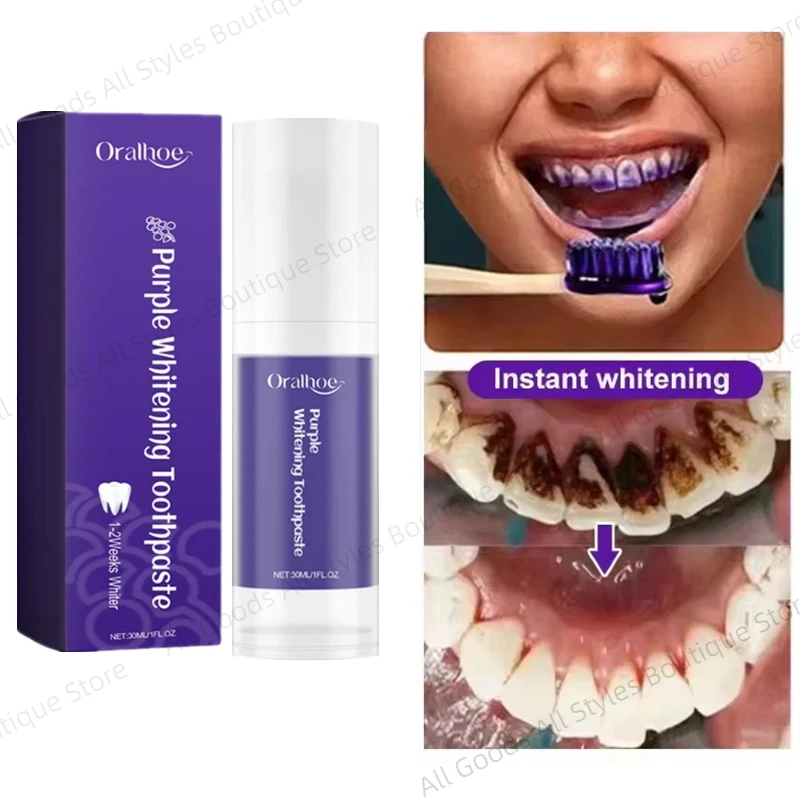 Фиолетовая отбеливающая зубная паста — освежение полости рта, уменьшение желтых пятен, чистка зубного камня и комплексный уход за зубами, новинка
Фиолетовая отбеливающая зубная паста — освежение полости рта, уменьшение желтых пятен, чистка зубного камня и комплексный уход за зубами, новинка