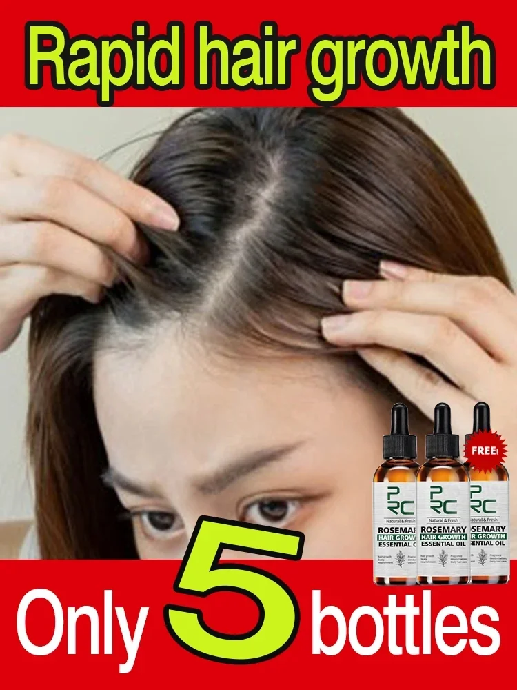 Essential Oils Ginger Anti Hair Loss Rosemary Oil Hair Growth for Men Women Fast Growing Products Scalp Treatment Hair Care
Essential Oils Ginger Anti Hair Loss Rosemary Oil Hair Growth for Men Women Fast Growing Products Scalp Treatment Hair Care