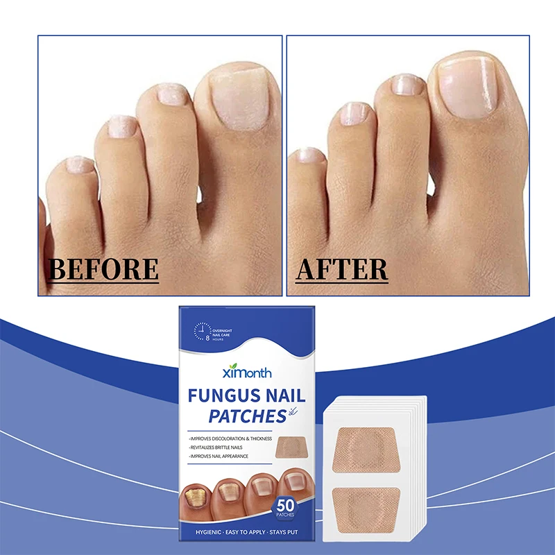 Hands And Feet Soft Nail Inlaid Nail Thickening Bright Nail Furrow Gray Nail Care Patch
Hands And Feet Soft Nail Inlaid Nail Thickening Bright Nail Furrow Gray Nail Care Patch