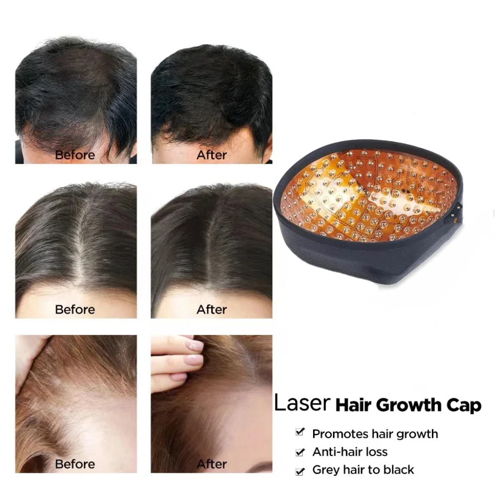 Laser Hair Growth Cap 96 Diodes - Rechargeable Hair Restoration Device for Women Men - Clinically Proven Hair Thickening
Laser Hair Growth Cap 96 Diodes - Rechargeable Hair Restoration Device for Women Men - Clinically Proven Hair Thickening