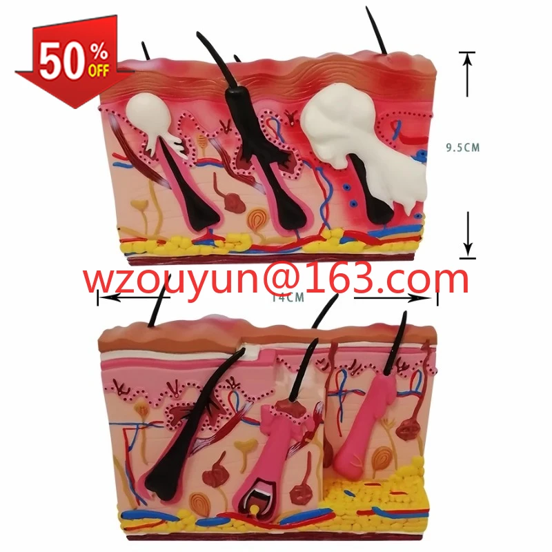 Skin Anatomy Model Acne Acne Epidermis Hair Follicle Anatomy Dermis Medical Aesthetic Plastic Skin Teaching Aids
Skin Anatomy Model Acne Acne Epidermis Hair Follicle Anatomy Dermis Medical Aesthetic Plastic Skin Teaching Aids