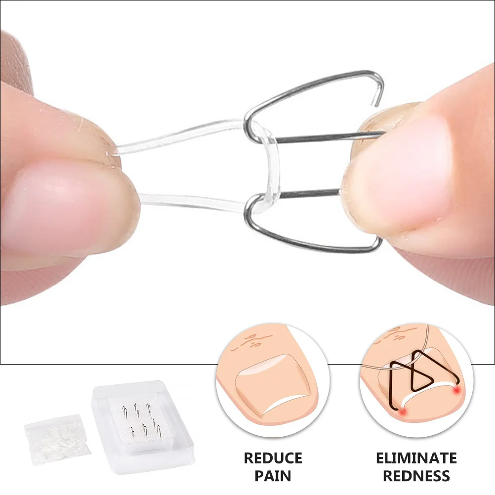 1Set Nail Straightening Corrector Fine Workmanship Compact Design for Toenail Growth Alignment Outdoor Travel Use Paronychia
1Set Nail Straightening Corrector Fine Workmanship Compact Design for Toenail Growth Alignment Outdoor Travel Use Paronychia