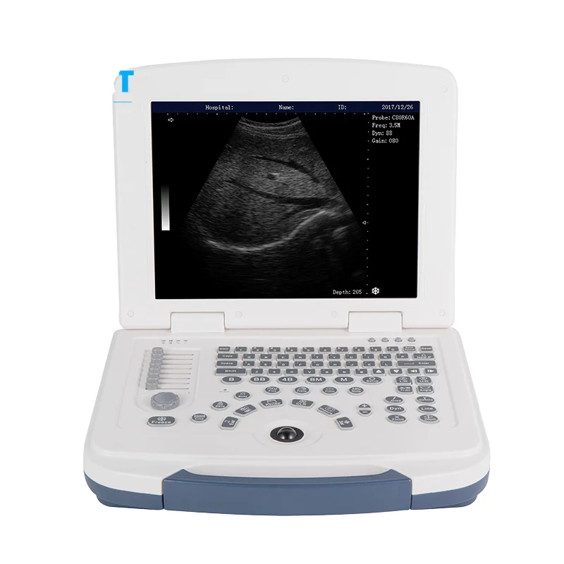 OSCAT EURPET Veterinary Ultrasound Small Size Scanner Physical Therapy Ultrasound Vet Technical Pet Machine
OSCAT EURPET Veterinary Ultrasound Small Size Scanner Physical Therapy Ultrasound Vet Technical Pet Machine