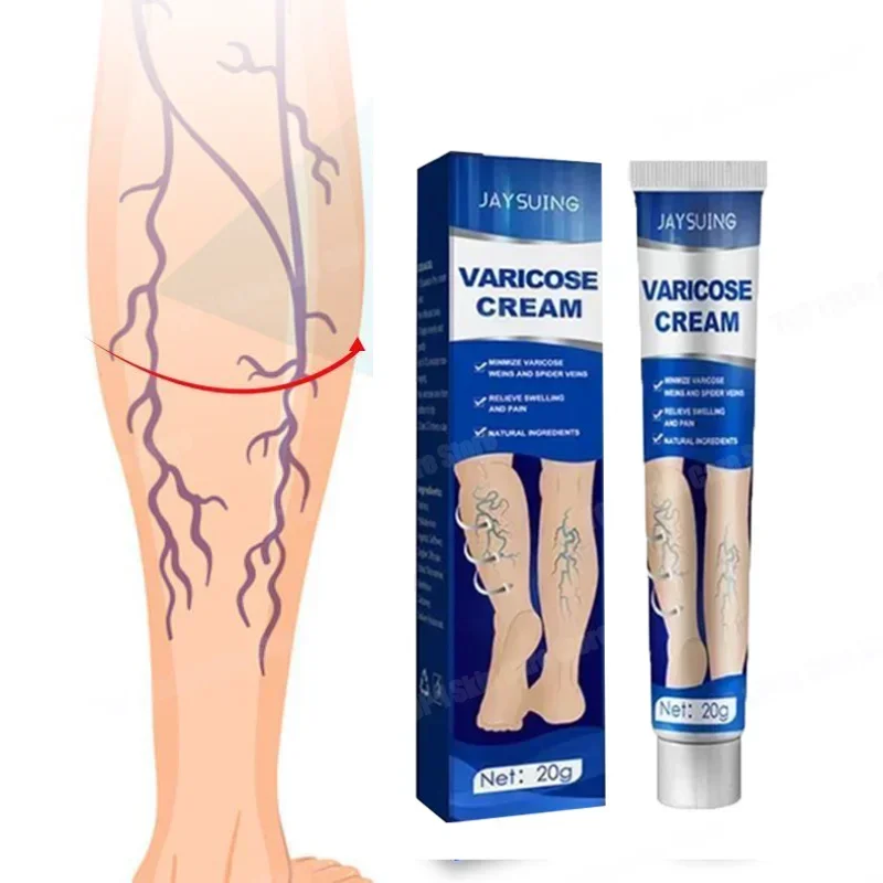 Effective variceal relief cream is used for the treatment of varicose veins to alleviate vasculitis, phlebitis
Effective variceal relief cream is used for the treatment of varicose veins to alleviate vasculitis, phlebitis