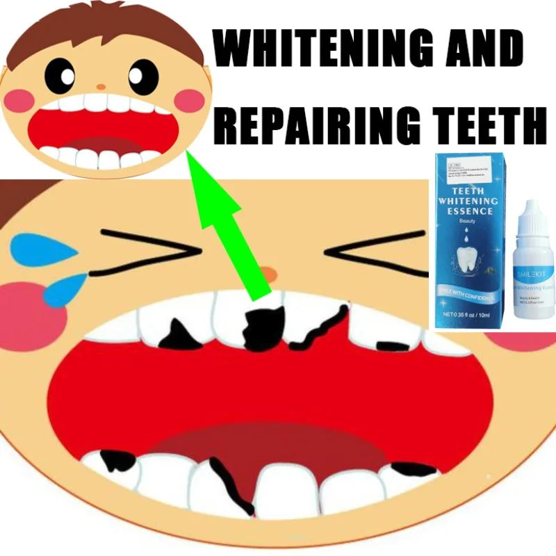 Whitening and refreshing oral cavity, removal of yellow teeth, care for whitening tools for black teeth
Whitening and refreshing oral cavity, removal of yellow teeth, care for whitening tools for black teeth