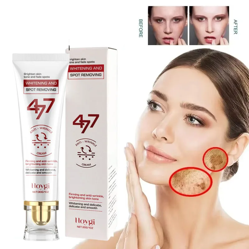 477 Blemish Cream Niacinamide Fast Whitening Blemish Cream Remove Freckles Brightening Skin Cream Firming Skin Nourishing
477 Blemish Cream Niacinamide Fast Whitening Blemish Cream Remove Freckles Brightening Skin Cream Firming Skin Nourishing