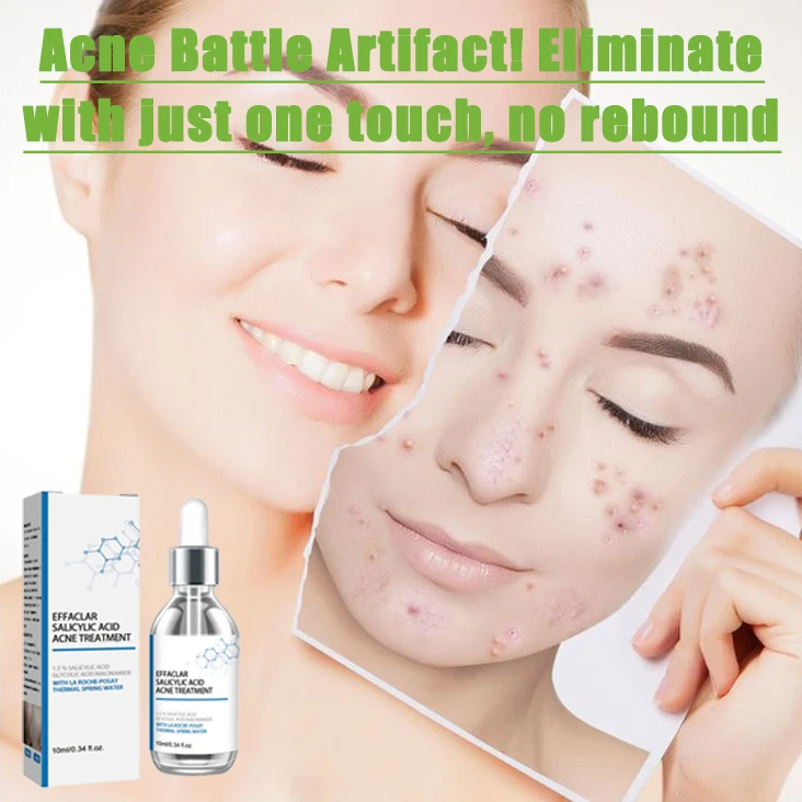Anti acne facial essence, acne removing and smoothing skin, collagen protein, hyaluronic acid essence oil, skin care cosmetics
Anti acne facial essence, acne removing and smoothing skin, collagen protein, hyaluronic acid essence oil, skin care cosmetics