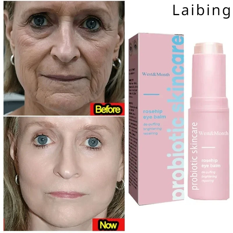 Women's Collagen Gloss Fine Line Repair Eye Cream Effectively Moisturizes Eyes Brightens Skin Dulls Skin Tone Beauty Cream
Women's Collagen Gloss Fine Line Repair Eye Cream Effectively Moisturizes Eyes Brightens Skin Dulls Skin Tone Beauty Cream