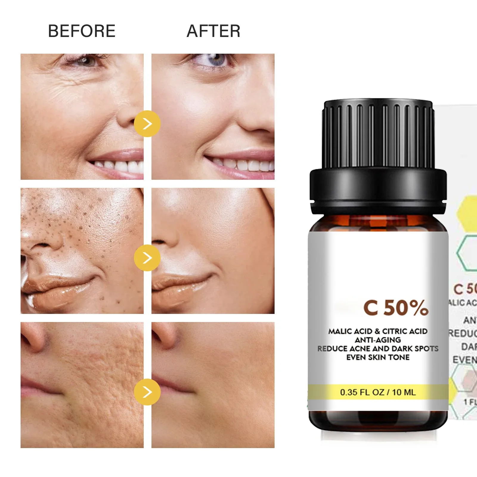 С яблочной кислотой и цирической кислотой для лица Пилинг для лица 50% Пилинг-сыворотка Пилинг-сыворотка Химический пилинг Отбеливающая питательная эссенция
С яблочной кислотой и цирической кислотой для лица Пилинг для лица 50% Пилинг-сыворотка Пилинг-сыворотка Химический пилинг Отбеливающая питательная эссенция