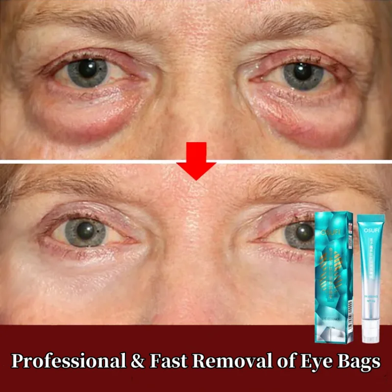 7 Days Remove Eye Bags Eye Cream Anti-Wrinkle Dark Circles Puffiness Lift Firm Serum Moisturizing Skin Care Beauty Products
7 Days Remove Eye Bags Eye Cream Anti-Wrinkle Dark Circles Puffiness Lift Firm Serum Moisturizing Skin Care Beauty Products