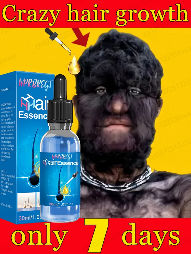 The latest technology hair growth essential oil, effective for hair, beard, chest hair, leg hair growth, has helped 200,000 peop
The latest technology hair growth essential oil, effective for hair, beard, chest hair, leg hair growth, has helped 200,000 peop