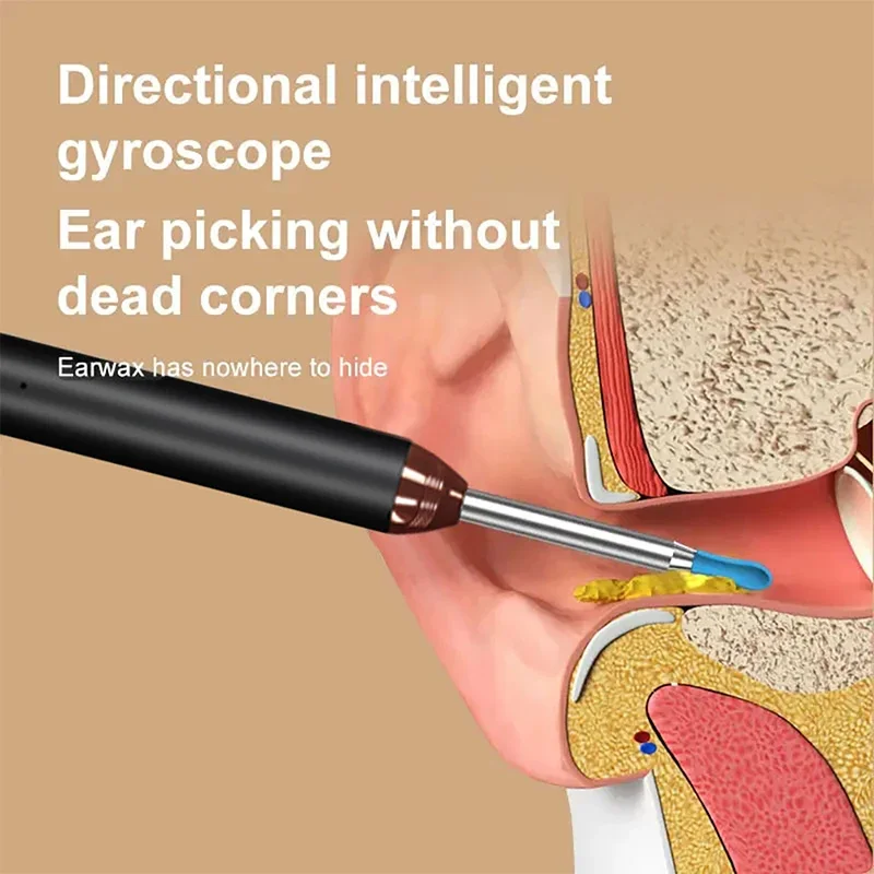 Smart Visual Ear Cleaner 1296P Ear Sticks Otoscope USB C Charging Endoscope Wax Removal Tool Earpick Camera Health Care No Harm
Smart Visual Ear Cleaner 1296P Ear Sticks Otoscope USB C Charging Endoscope Wax Removal Tool Earpick Camera Health Care No Harm