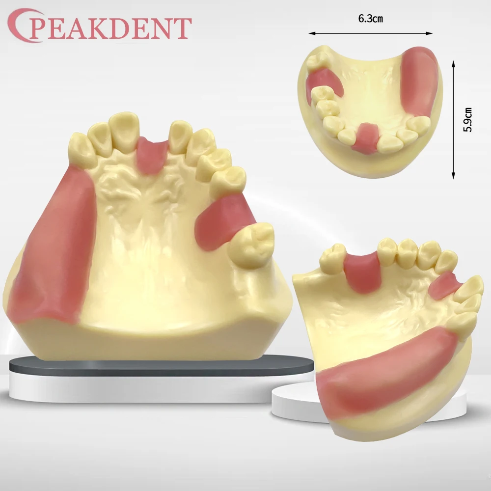 Dental Model Mandibular Jaw Implant Study Education Teach With Missing Tooth Dental Implant Teeth Model Dentist Studying Demo
Dental Model Mandibular Jaw Implant Study Education Teach With Missing Tooth Dental Implant Teeth Model Dentist Studying Demo