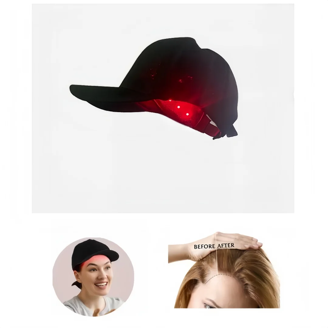 Hair Growth Cap LED Health Light Device Anti Hair Loss Anxiety Stress Relax Massager Red Hair Growth Cap Device
Hair Growth Cap LED Health Light Device Anti Hair Loss Anxiety Stress Relax Massager Red Hair Growth Cap Device