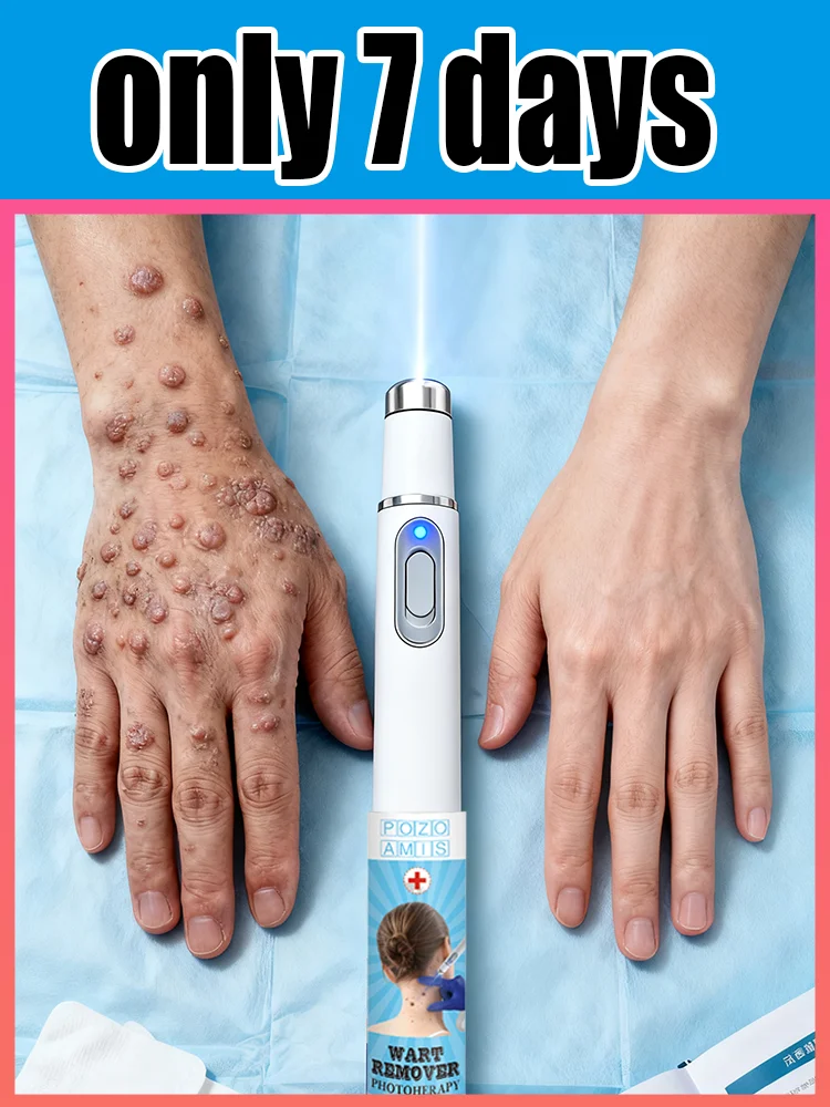 ʙʟᴜᴇ ʟɪɢʜᴛ ᴘᴇɴ sᴏʟᴠᴇ ᴡᴀʀᴛs, ʜᴏᴛ sᴀʟᴇ ᴡᴀʀᴛ ᴄᴀʀᴇ ᴛᴏᴏʟs
ʙʟᴜᴇ ʟɪɢʜᴛ ᴘᴇɴ sᴏʟᴠᴇ ᴡᴀʀᴛs, ʜᴏᴛ sᴀʟᴇ ᴡᴀʀᴛ ᴄᴀʀᴇ ᴛᴏᴏʟs