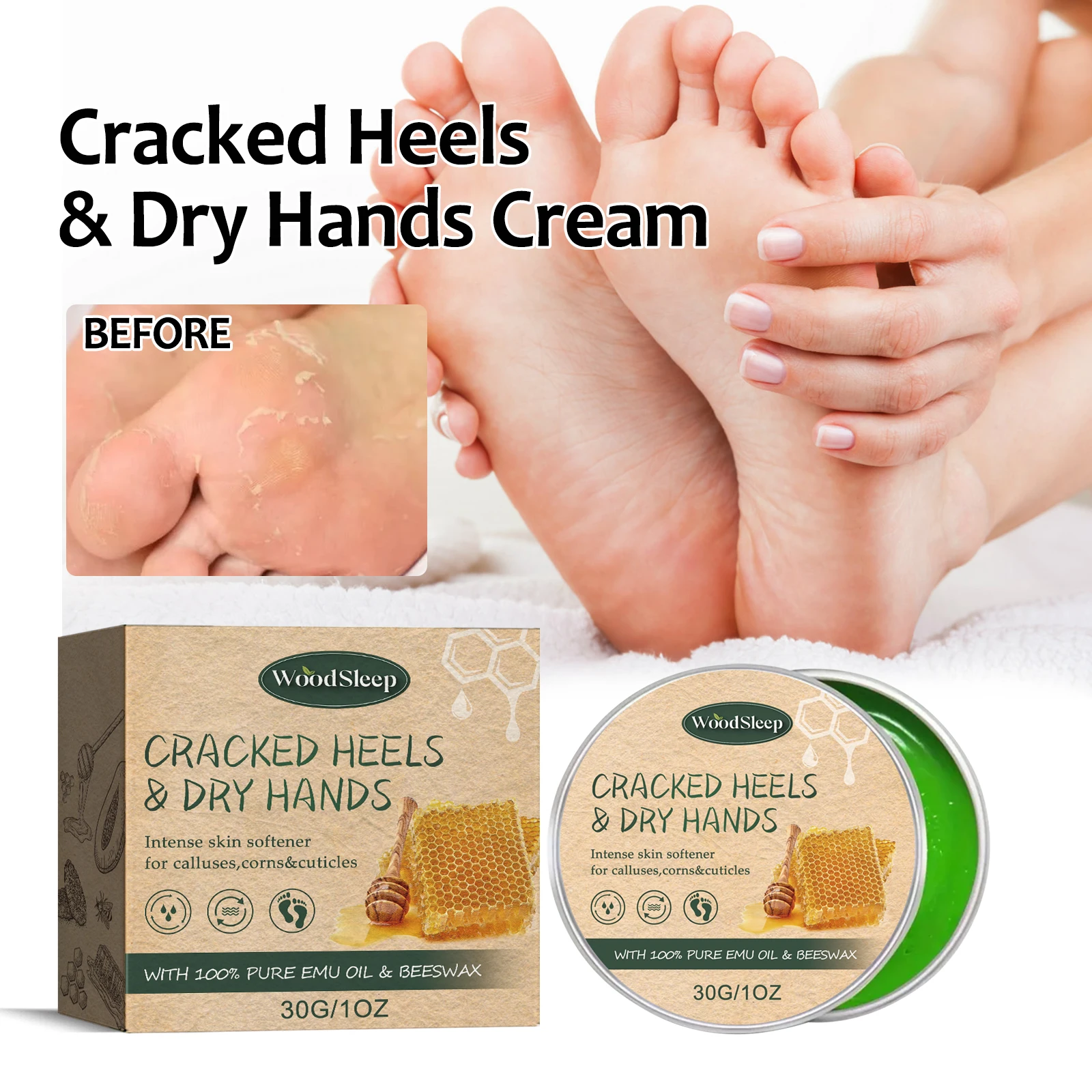 WoodSleep Anti-dry Hand and Foot Care Cream Skin-friendly Moisturizing Anti-dry Cracked Hand and Foot State Moisturizing Nursing
WoodSleep Anti-dry Hand and Foot Care Cream Skin-friendly Moisturizing Anti-dry Cracked Hand and Foot State Moisturizing Nursing