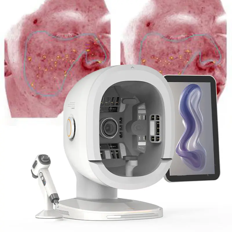 K33 Skin Analysis Device 3 Cameras 15.6 Inch Screen 3D Skin Analyzer Facial Analyzer Corneometer Measure Skin for Beauty Spa
K33 Skin Analysis Device 3 Cameras 15.6 Inch Screen 3D Skin Analyzer Facial Analyzer Corneometer Measure Skin for Beauty Spa