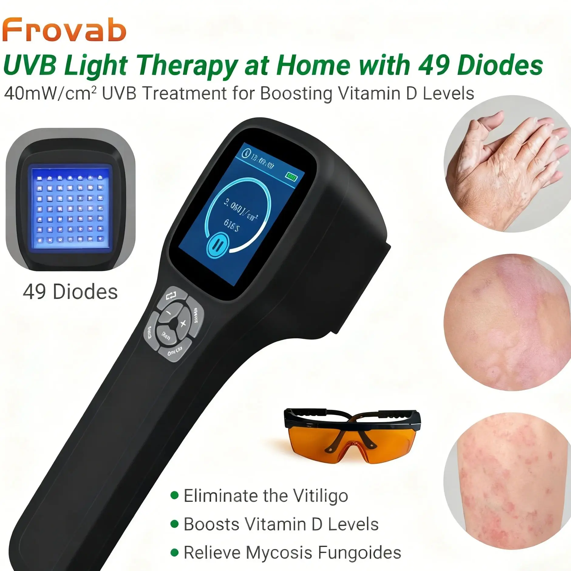 Frovab Handheld 308nm UVB Light Therapy Machine 49 Diodes Portable Phototherapy for Skin Disease Vitiligo Eczema Home Care
Frovab Handheld 308nm UVB Light Therapy Machine 49 Diodes Portable Phototherapy for Skin Disease Vitiligo Eczema Home Care