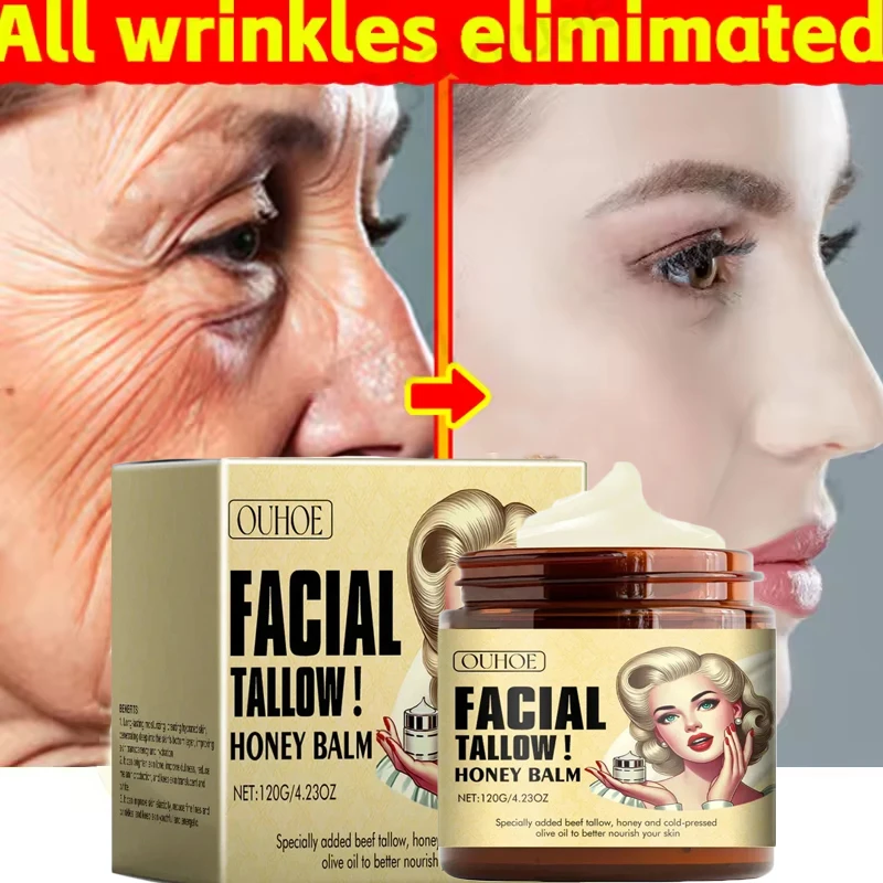 120g Whipped Beef Tallow Cream And Honey Balm Moisturizing Beef Tallow Serum Body Lotion Grass Fed Grass Finished Face Lip Care
120g Whipped Beef Tallow Cream And Honey Balm Moisturizing Beef Tallow Serum Body Lotion Grass Fed Grass Finished Face Lip Care