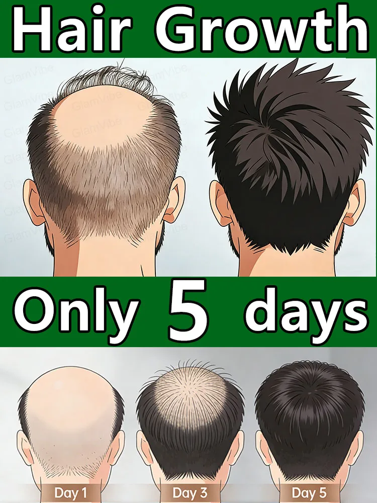 Upgraded 2nd Gen: Awaken hair roots, thicker hair in 7 days. Free shipping!
Upgraded 2nd Gen: Awaken hair roots, thicker hair in 7 days. Free shipping!