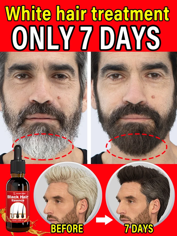 White to Black Hair Serum-Natural Gray Hair Treatment for Men & Women, with Biotin& Keratin, remove gray hair 7-day fast results
White to Black Hair Serum-Natural Gray Hair Treatment for Men & Women, with Biotin& Keratin, remove gray hair 7-day fast results