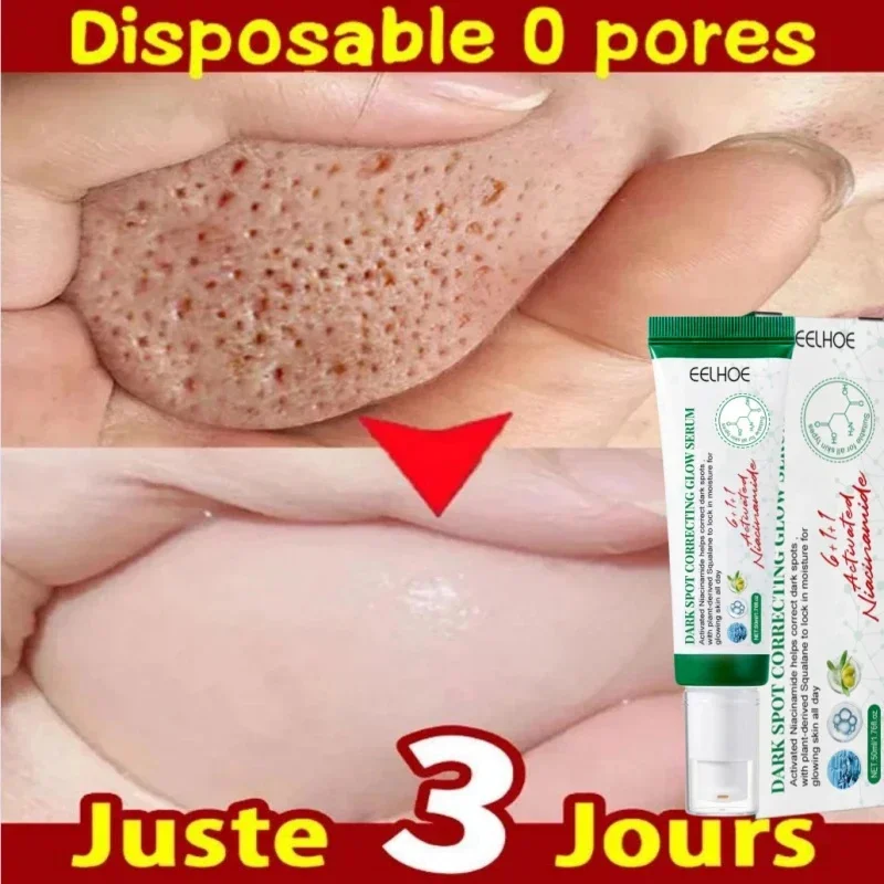 Pore Shrinking Cream Acne Pit Repair Product for Men Women Remove Acne Print Scar Large Pore Anti-inflammatory Smooth Skin Cream
Pore Shrinking Cream Acne Pit Repair Product for Men Women Remove Acne Print Scar Large Pore Anti-inflammatory Smooth Skin Cream