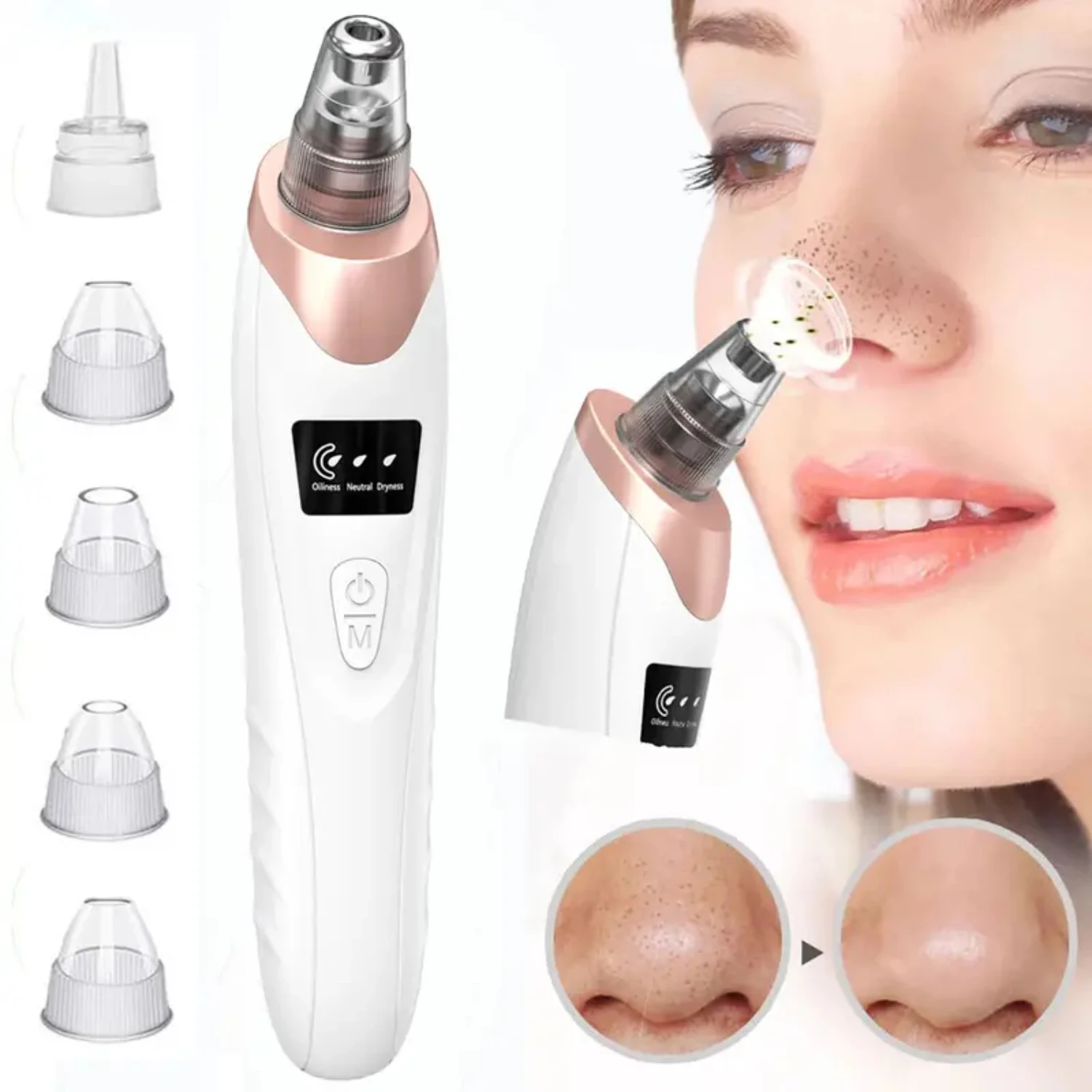 Acne toolDark spot removerFace cleanerPinple patchWart remover extra strongFace capilar laserDark spot remover for faceBeutySpa
Acne toolDark spot removerFace cleanerPinple patchWart remover extra strongFace capilar laserDark spot remover for faceBeutySpa