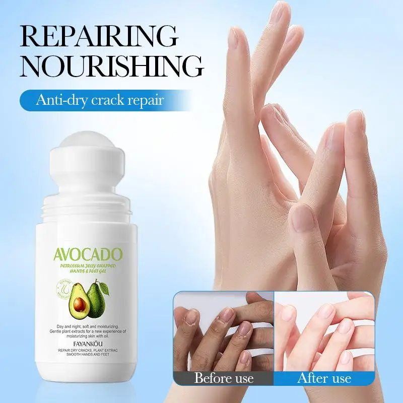 Hands And Feet Chapping Gel Heel Hydrating Repair Intensive Care For Cracked Heels Moisturizes In Autumn And Winter
Hands And Feet Chapping Gel Heel Hydrating Repair Intensive Care For Cracked Heels Moisturizes In Autumn And Winter