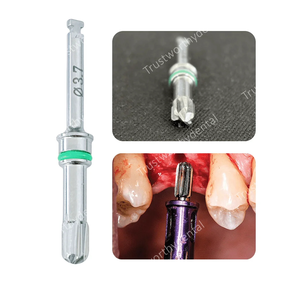 Φ3.7 Dental SD Reamers Drill Crestal Approach Perforate Sinus Wall Membrane Lifting Lifeter Burs Round Head Reamer
Φ3.7 Dental SD Reamers Drill Crestal Approach Perforate Sinus Wall Membrane Lifting Lifeter Burs Round Head Reamer