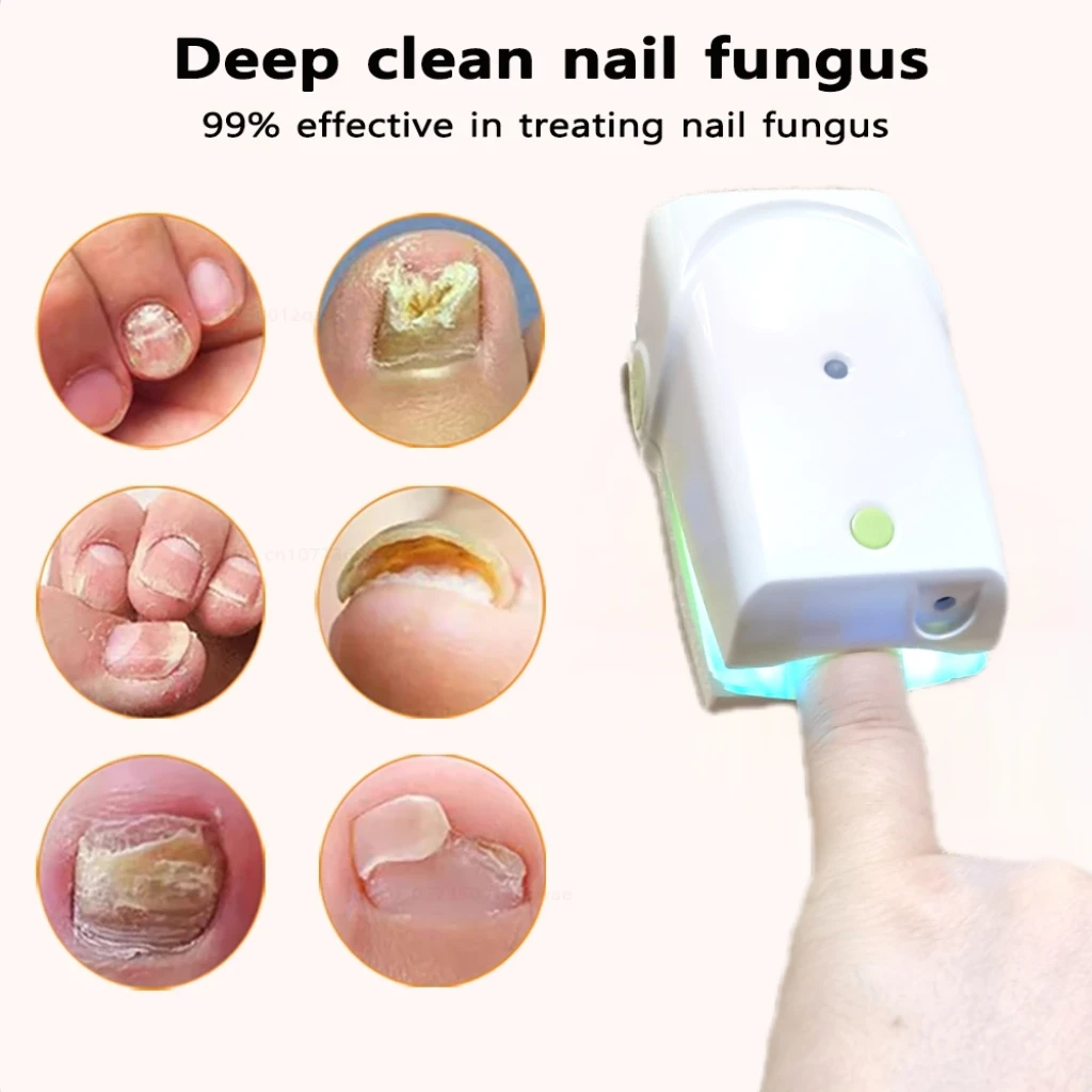 Professional Nail Care Laser Equipment Helps with Onychomycosis & Ingrown Toenail Maintenance, Rechargeable
Professional Nail Care Laser Equipment Helps with Onychomycosis & Ingrown Toenail Maintenance, Rechargeable